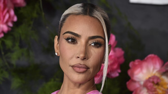 kim kardashian: hat kaum noch haare