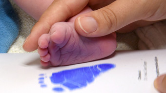 Versorgung gesichert? Weniger Geburtskliniken in Hessen