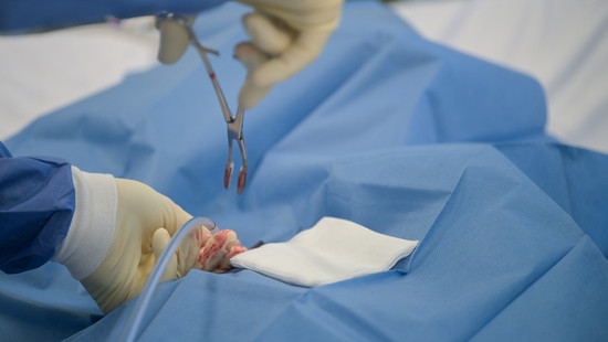 Organspende: Neuer Vorstoß für Widerspruchs-Regelung