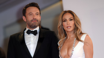 jennifer lopez: schickt ben affleck zum beauty-doc