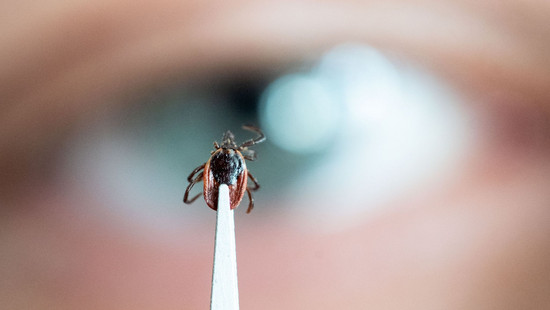 Zecken in Hessen: Über 13.000 Borreliose-Fälle