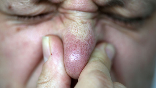 Gestank-Alarm am Untermain: Ursache bleibt unklar